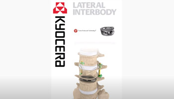 Lateral Interbody
